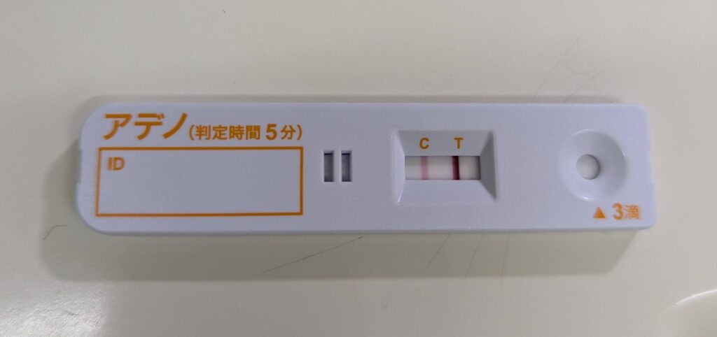 アデノウイルス結膜炎（はやり目）になった